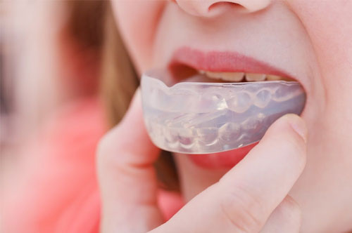 Get a Mouthguard for Better Oral & Overall Health